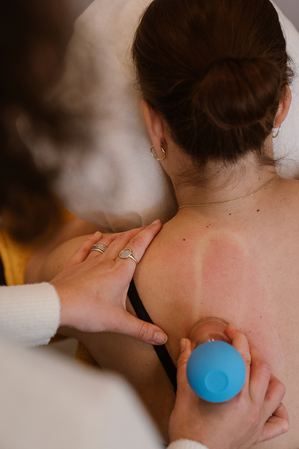 Praktijk Anne Ditmar - Guasha & cupping therapie - HSP coaching