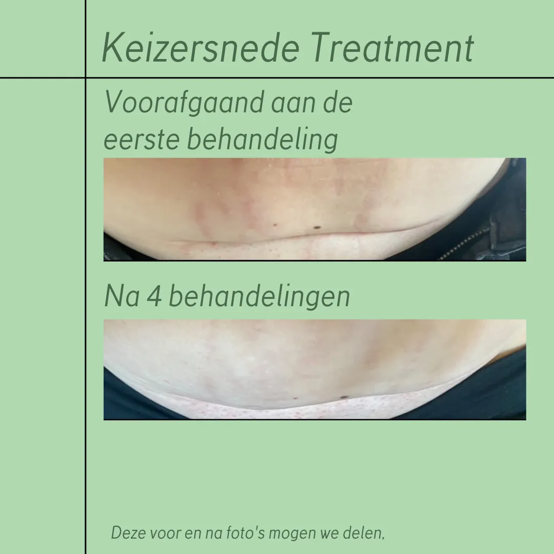 Baby Spa & Wellness Sappemeer