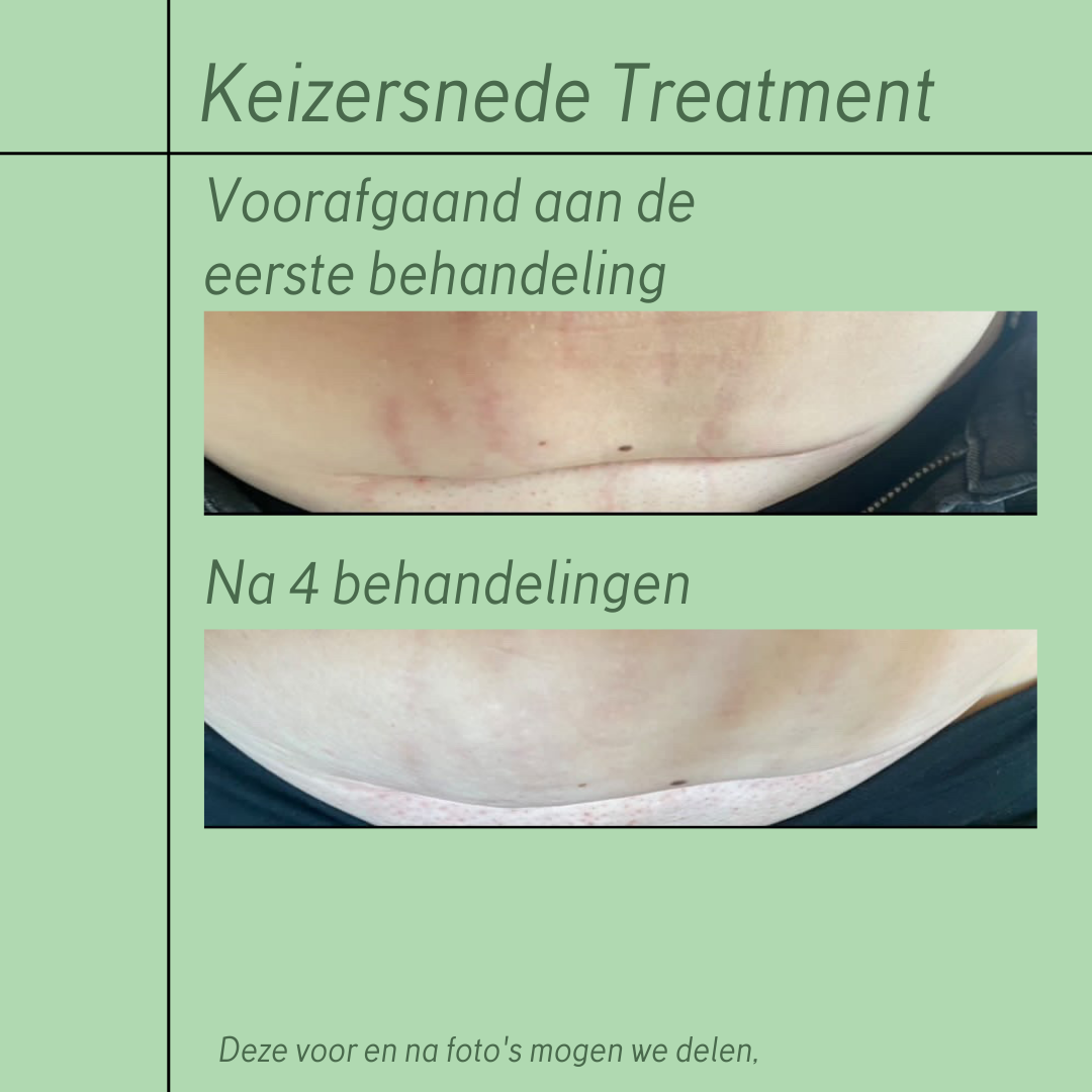 Baby Spa & Wellness Sappemeer