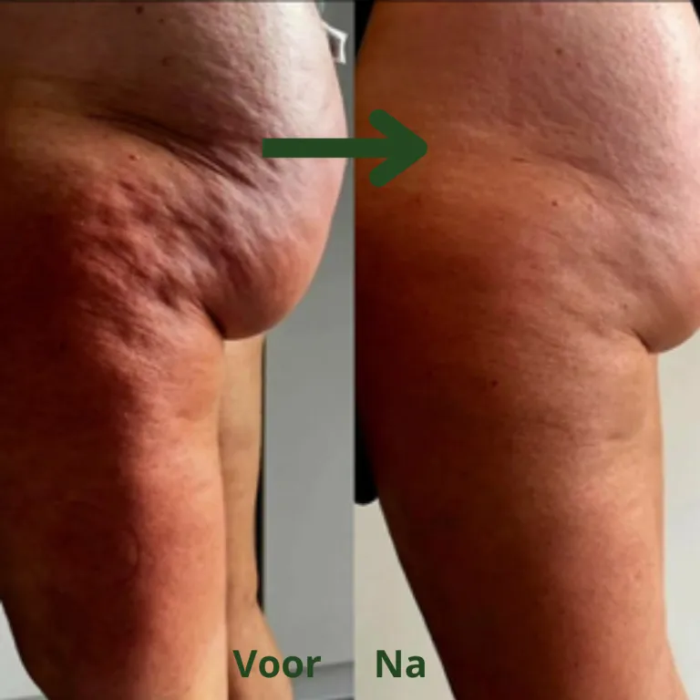 Balance by Cupping